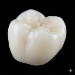 Corona de circonia