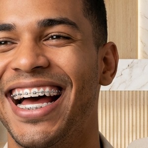 Paciente con brackets, inicial dividida